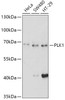 Western blot analysis of extracts of various cell lines, using PLK1 antibody (18-702) at 1:500 dilution.<br/>Secondary antibody: HRP Goat Anti-Rabbit IgG (H+L) at 1:10000 dilution.<br/>Lysates/proteins: 25ug per lane.<br/>Blocking buffer: 3% nonfat dry milk in TBST.<br/>Detection: ECL Basic Kit.<br/>Exposure time: 90s.