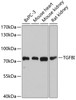 Western blot analysis of extracts of various cell lines, using TGFBI antibody (18-712) at 1:1000 dilution.<br/>Secondary antibody: HRP Goat Anti-Rabbit IgG (H+L) at 1:10000 dilution.<br/>Lysates/proteins: 25ug per lane.<br/>Blocking buffer: 3% nonfat dry milk in TBST.<br/>Detection: ECL Basic Kit.<br/>Exposure time: 5s.