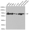 Western blot analysis of extracts of various cell lines, using AIF antibody (18-715) at 1:1000 dilution.<br/>Secondary antibody: HRP Goat Anti-Rabbit IgG (H+L) at 1:10000 dilution.<br/>Lysates/proteins: 25ug per lane.<br/>Blocking buffer: 3% nonfat dry milk in TBST.