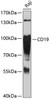 Western blot analysis of extracts of Raji cells, using CD19 Antibody (18-721) at 1:3000 dilution.<br/>Secondary antibody: HRP Goat Anti-Rabbit IgG (H+L) at 1:10000 dilution.<br/>Lysates/proteins: 25ug per lane.<br/>Blocking buffer: 3% nonfat dry milk in TBST.<br/>Detection: ECL Basic Kit.<br/>Exposure time: 90s.