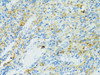 Immunohistochemistry of paraffin-embedded rat spleen using CD19 antibody (18-721) at dilution of 1:100 (40x lens) .