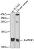 Western blot analysis of extracts of various cell lines, using LAMTOR5 antibody (18-735) at 1:1000 dilution.<br/>Secondary antibody: HRP Goat Anti-Rabbit IgG (H+L) at 1:10000 dilution.<br/>Lysates/proteins: 25ug per lane.<br/>Blocking buffer: 3% nonfat dry milk in TBST.<br/>Detection: ECL Enhanced Kit.<br/>Exposure time: 10s.