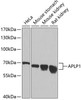 Western blot analysis of extracts of various cell lines, using APLP1 antibody (18-746) at 1:1000 dilution.<br/>Secondary antibody: HRP Goat Anti-Rabbit IgG (H+L) at 1:10000 dilution.<br/>Lysates/proteins: 25ug per lane.<br/>Blocking buffer: 3% nonfat dry milk in TBST.<br/>Detection: ECL Basic Kit.<br/>Exposure time: 30s.
