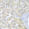 Immunohistochemistry of paraffin-embedded human liver damage using ABCB8 antibody (18-750) at dilution of 1:100 (40x lens) .