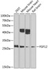 Western blot analysis of extracts of various cell lines, using FGF12 antibody (18-759) at 1:1000 dilution._Secondary antibody: HRP Goat Anti-Rabbit IgG (H+L) at 1:10000 dilution._Lysates/proteins: 25ug per lane._Blocking buffer: 3% nonfat dry milk in TBST._Detection: ECL Enhanced Kit._Exposure time: 90s.