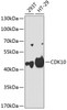 Western blot analysis of extracts of various cell lines, using CDK10 antibody (18-768) at 1:1000 dilution.<br/>Secondary antibody: HRP Goat Anti-Rabbit IgG (H+L) at 1:10000 dilution.<br/>Lysates/proteins: 25ug per lane.<br/>Blocking buffer: 3% nonfat dry milk in TBST.<br/>Detection: ECL Basic Kit.<br/>Exposure time: 90s.