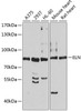 Western blot analysis of extracts of various cell lines, using ELN antibody (18-787) at 1:1000 dilution.<br/>Secondary antibody: HRP Goat Anti-Rabbit IgG (H+L) at 1:10000 dilution.<br/>Lysates/proteins: 25ug per lane.<br/>Blocking buffer: 3% nonfat dry milk in TBST.<br/>Detection: ECL Basic Kit.<br/>Exposure time: 60s.