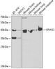 Western blot analysis of extracts of various cell lines, using GNA11 antibody (18-792) at 1:400 dilution.<br/>Secondary antibody: HRP Goat Anti-Rabbit IgG (H+L) at 1:10000 dilution.<br/>Lysates/proteins: 25ug per lane.<br/>Blocking buffer: 3% nonfat dry milk in TBST.<br/>Detection: ECL Basic Kit.<br/>Exposure time: 90s.