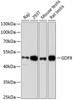 Western blot analysis of extracts of various cell lines, using GDF9 antibody (18-796) at 1:3000 dilution.<br/>Secondary antibody: HRP Goat Anti-Rabbit IgG (H+L) at 1:10000 dilution.<br/>Lysates/proteins: 25ug per lane.<br/>Blocking buffer: 3% nonfat dry milk in TBST.<br/>Detection: ECL Basic Kit.<br/>Exposure time: 90s.