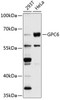 Western blot analysis of extracts of various cell lines, using GPC6 antibody (18-797) at 1:1000 dilution.<br/>Secondary antibody: HRP Goat Anti-Rabbit IgG (H+L) at 1:10000 dilution.<br/>Lysates/proteins: 25ug per lane.<br/>Blocking buffer: 3% nonfat dry milk in TBST.<br/>Detection: ECL Basic Kit.<br/>Exposure time: 10s.