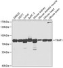 Western blot analysis of extracts of various cell lines, using TRAP1 antibody (18-800) at 1:1000 dilution.<br/>Secondary antibody: HRP Goat Anti-Rabbit IgG (H+L) at 1:10000 dilution.<br/>Lysates/proteins: 25ug per lane.<br/>Blocking buffer: 3% nonfat dry milk in TBST.<br/>Detection: ECL Basic Kit.<br/>Exposure time: 10s.