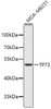 Western blot analysis of extracts of MDA-MB231 cells, using TP73 antibody (18-810) .<br/>Secondary antibody: HRP Goat Anti-Rabbit IgG (H+L) at 1:10000 dilution.<br/>Lysates/proteins: 25ug per lane.<br/>Blocking buffer: 3% nonfat dry milk in TBST.
