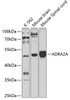 Western blot analysis of extracts of various cell lines, using ADRA2A antibody (18-821) at 1:1000 dilution.<br/>Secondary antibody: HRP Goat Anti-Rabbit IgG (H+L) at 1:10000 dilution.<br/>Lysates/proteins: 25ug per lane.<br/>Blocking buffer: 3% nonfat dry milk in TBST.<br/>Detection: ECL Basic Kit.<br/>Exposure time: 30s.