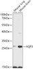 Western blot analysis of extracts of various cell lines, using AQP3 antibody (18-832) at 1:1000 dilution.<br/>Secondary antibody: HRP Goat Anti-Rabbit IgG (H+L) at 1:10000 dilution.<br/>Lysates/proteins: 25ug per lane.<br/>Blocking buffer: 3% nonfat dry milk in TBST.<br/>Detection: ECL Basic Kit.<br/>Exposure time: 90s.