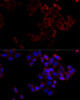 Immunofluorescence analysis of HeLa cells using Bcl2 antibody (18-834) at dilution of 1:100 (40x lens) . Blue: DAPI for nuclear staining.