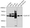 Western blot analysis of extracts of various cell lines, using Cyclin A2 antibody (18-852) at 1:1000 dilution.<br/>Secondary antibody: HRP Goat Anti-Rabbit IgG (H+L) at 1:10000 dilution.<br/>Lysates/proteins: 25ug per lane.<br/>Blocking buffer: 3% nonfat dry milk in TBST.<br/>Detection: ECL Basic Kit.<br/>Exposure time: 30s.