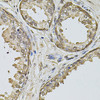 Immunohistochemistry of paraffin-embedded human prostate using Cyclin A2 antibody (18-852) at dilution of 1:100 (40x lens) .