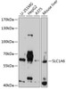 Western blot analysis of extracts of various cell lines, using SLC1A6 antibody (18-863) at 1:1000 dilution.<br/>Secondary antibody: HRP Goat Anti-Rabbit IgG (H+L) at 1:10000 dilution.<br/>Lysates/proteins: 25ug per lane.<br/>Blocking buffer: 3% nonfat dry milk in TBST.<br/>Detection: ECL Basic Kit.<br/>Exposure time: 90s.