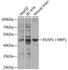 Western blot analysis of extracts of various cell lines, using DUSP1 / MKP1 Antibody (18-871) at 1:300 dilution.<br/>Secondary antibody: HRP Goat Anti-Rabbit IgG (H+L) at 1:10000 dilution.<br/>Lysates/proteins: 25ug per lane.<br/>Blocking buffer: 3% nonfat dry milk in TBST.<br/>Detection: ECL Enhanced Kit.