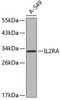 Western blot analysis of extracts of A-549 cells, using IL2RA antibody (18-894) .<br/>Secondary antibody: HRP Goat Anti-Rabbit IgG (H+L) at 1:10000 dilution.<br/>Lysates/proteins: 25ug per lane.<br/>Blocking buffer: 3% nonfat dry milk in TBST.