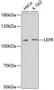 Western blot analysis of extracts of various cell lines, using LEPR antibody (18-901) at 1:500 dilution.<br/>Secondary antibody: HRP Goat Anti-Rabbit IgG (H+L) at 1:10000 dilution.<br/>Lysates/proteins: 25ug per lane.<br/>Blocking buffer: 3% nonfat dry milk in TBST.<br/>Detection: ECL Basic Kit.<br/>Exposure time: 90s.