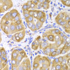 Immunohistochemistry of paraffin-embedded human liver cancer using LRPAP1 Antibody (18-902) at dilution of 1:100 (40x lens) .