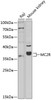 Western blot analysis of extracts of various cell lines, using MC2R antibody (18-905) at 1:500 dilution.<br/>Secondary antibody: HRP Goat Anti-Rabbit IgG (H+L) at 1:10000 dilution.<br/>Lysates/proteins: 25ug per lane.<br/>Blocking buffer: 3% nonfat dry milk in TBST.