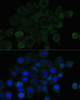 Immunofluorescence analysis of HeLa cells using E-Cadherin antibody (18-916) at dilution of 1:100. Blue: DAPI for nuclear staining.