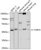 Western blot analysis of extracts of various cell lines, using P2RY4 antibody (18-923) at 1:1000 dilution.<br/>Secondary antibody: HRP Goat Anti-Rabbit IgG (H+L) at 1:10000 dilution.<br/>Lysates/proteins: 25ug per lane.<br/>Blocking buffer: 3% nonfat dry milk in TBST.<br/>Detection: ECL Basic Kit.<br/>Exposure time: 5s.