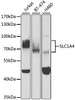 Western blot analysis of extracts of various cell lines, using SLC1A4 antibody (18-934) at 1:400 dilution.<br/>Secondary antibody: HRP Goat Anti-Rabbit IgG (H+L) at 1:10000 dilution.<br/>Lysates/proteins: 25ug per lane.<br/>Blocking buffer: 3% nonfat dry milk in TBST.<br/>Detection: ECL Basic Kit.<br/>Exposure time: 60s.