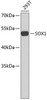 Western blot analysis of extracts of 293T cells, using SOX1 antibody (18-935) .<br/>Secondary antibody: HRP Goat Anti-Rabbit IgG (H+L) at 1:10000 dilution.<br/>Lysates/proteins: 25ug per lane.<br/>Blocking buffer: 3% nonfat dry milk in TBST.