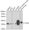 Western blot analysis of extracts of various cell lines, using TPM2 antibody (18-940) at 1:400 dilution.<br/>Secondary antibody: HRP Goat Anti-Rabbit IgG (H+L) at 1:10000 dilution.<br/>Lysates/proteins: 25ug per lane.<br/>Blocking buffer: 3% nonfat dry milk in TBST.<br/>Detection: ECL Basic Kit.<br/>Exposure time: 90s.