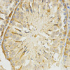 Immunohistochemistry of paraffin-embedded rat testis using TPM2 antibody (18-940) at dilution of 1:200 (40x lens) .