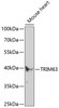 Western blot analysis of extracts of mouse heart, using TRIM63 antibody (18-941) at 1:400 dilution.<br/>Secondary antibody: HRP Goat Anti-Rabbit IgG (H+L) at 1:10000 dilution.<br/>Lysates/proteins: 25ug per lane.<br/>Blocking buffer: 3% nonfat dry milk in TBST.<br/>Detection: ECL Enhanced Kit.<br/>Exposure time: 90s.