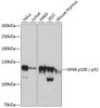 Western blot analysis of extracts of various cell lines, using NFkB p100 / p52 antibody (18-945) at 1:3000 dilution.<br/>Secondary antibody: HRP Goat Anti-Rabbit IgG (H+L) at 1:10000 dilution.<br/>Lysates/proteins: 25ug per lane.<br/>Blocking buffer: 3% nonfat dry milk in TBST.<br/>Detection: ECL Basic Kit.<br/>Exposure time: 30s.