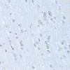 Immunohistochemistry of paraffin-embedded rat brain using NFkB p100 / p52 antibody (18-945) at dilution of 1:100 (40x lens) .