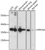 Western blot analysis of extracts of various cell lines, using PPP2CB antibody (18-952) at 1:1000 dilution.<br/>Secondary antibody: HRP Goat Anti-Rabbit IgG (H+L) at 1:10000 dilution.<br/>Lysates/proteins: 25ug per lane.<br/>Blocking buffer: 3% nonfat dry milk in TBST.<br/>Detection: ECL Basic Kit.<br/>Exposure time: 30s.