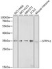 Western blot analysis of extracts of various cell lines, using SFTPA1 antibody (18-957) at 1:200 dilution.<br/>Secondary antibody: HRP Goat Anti-Rabbit IgG (H+L) at 1:10000 dilution.<br/>Lysates/proteins: 25ug per lane.<br/>Blocking buffer: 3% nonfat dry milk in TBST.<br/>Detection: ECL Enhanced Kit.<br/>Exposure time: 30s.