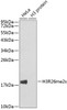 Western blot analysis of extracts of various cell lines, using Symmetric DiMethyl-Histone H3-R26 antibody (18-965) .<br/>Secondary antibody: HRP Goat Anti-Rabbit IgG (H+L) at 1:10000 dilution.<br/>Lysates/proteins: 25ug per lane.<br/>Blocking buffer: 3% nonfat dry milk in TBST.