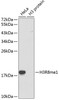 Western blot analysis of extracts of various cell lines, using MonoMethyl-Histone H3-R8 antibody (18-968) .<br/>Secondary antibody: HRP Goat Anti-Rabbit IgG (H+L) at 1:10000 dilution.<br/>Lysates/proteins: 25ug per lane.<br/>Blocking buffer: 3% nonfat dry milk in TBST.