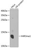 Western blot analysis of extracts of various cell lines, using MonoMethyl-Histone H4-R3 antibody (18-970) .<br/>Secondary antibody: HRP Goat Anti-Rabbit IgG (H+L) at 1:10000 dilution.<br/>Lysates/proteins: 25ug per lane.<br/>Blocking buffer: 3% nonfat dry milk in TBST.