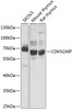 Western blot analysis of extracts of various cell lines, using CDKN2AIP antibody (19-003) at 1:1000 dilution.<br/>Secondary antibody: HRP Goat Anti-Rabbit IgG (H+L) at 1:10000 dilution.<br/>Lysates/proteins: 25ug per lane.<br/>Blocking buffer: 3% nonfat dry milk in TBST.<br/>Detection: ECL Basic Kit.<br/>Exposure time: 5s.