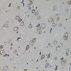 Immunohistochemistry of paraffin-embedded rat brain using UQCRC1 antibody (19-039) at dilution of 1:100 (40x lens) .