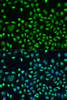 Immunofluorescence analysis of U2OS cells using STAU2 antibody (19-060) at dilution of 1:100. Blue: DAPI for nuclear staining.