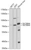 Western blot analysis of extracts of various cell lines, using SLC39A4 antibody (19-072) at 1:1000 dilution.<br/>Secondary antibody: HRP Goat Anti-Rabbit IgG (H+L) at 1:10000 dilution.<br/>Lysates/proteins: 25ug per lane.<br/>Blocking buffer: 3% nonfat dry milk in TBST.<br/>Detection: ECL Basic Kit.<br/>Exposure time: 90s.