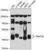 Western blot analysis of extracts of various cell lines, using TRMT2B antibody (19-081) at 1:1000 dilution.<br/>Secondary antibody: HRP Goat Anti-Rabbit IgG (H+L) at 1:10000 dilution.<br/>Lysates/proteins: 25ug per lane.<br/>Blocking buffer: 3% nonfat dry milk in TBST.<br/>Detection: ECL Basic Kit.<br/>Exposure time: 1s.