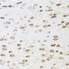 Immunohistochemistry of paraffin-embedded rat brain using ARHGAP5 antibody (19-096) at dilution of 1:100 (40x lens) .