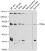 Western blot analysis of extracts of various cell lines, using CCT6A antibody (19-097) at 1:1000 dilution.<br/>Secondary antibody: HRP Goat Anti-Rabbit IgG (H+L) at 1:10000 dilution.<br/>Lysates/proteins: 25ug per lane.<br/>Blocking buffer: 3% nonfat dry milk in TBST.<br/>Detection: ECL Basic Kit.<br/>Exposure time: 90s.