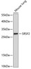 Western blot analysis of extracts of mouse lung, using SRSF2 antibody (19-113) at 1:1000 dilution._Secondary antibody: HRP Goat Anti-Rabbit IgG (H+L) at 1:10000 dilution._Lysates/proteins: 25ug per lane._Blocking buffer: 3% nonfat dry milk in TBST._Detection: ECL Enhanced Kit._Exposure time: 90s.