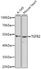 Western blot analysis of extracts of various cell lines, using TGFB2 antibody (19-116) at 1:1000 dilution.<br/>Secondary antibody: HRP Goat Anti-Rabbit IgG (H+L) at 1:10000 dilution.<br/>Lysates/proteins: 25ug per lane.<br/>Blocking buffer: 3% nonfat dry milk in TBST.<br/>Detection: ECL Basic Kit.<br/>Exposure time: 30s.